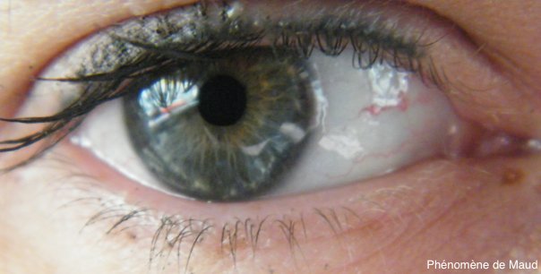 mon oeil.jpg